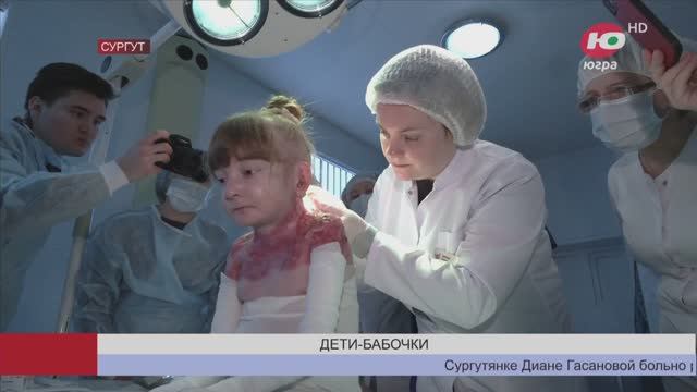Первые дети-бабочки из Югры получили генную терапию