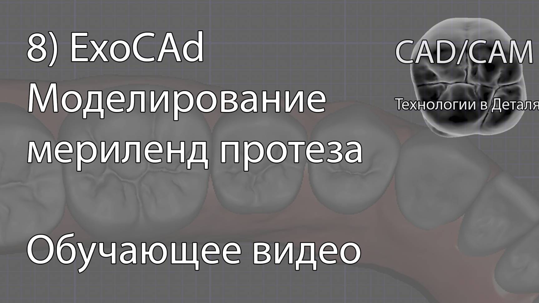 Моделирование мериленд протеза