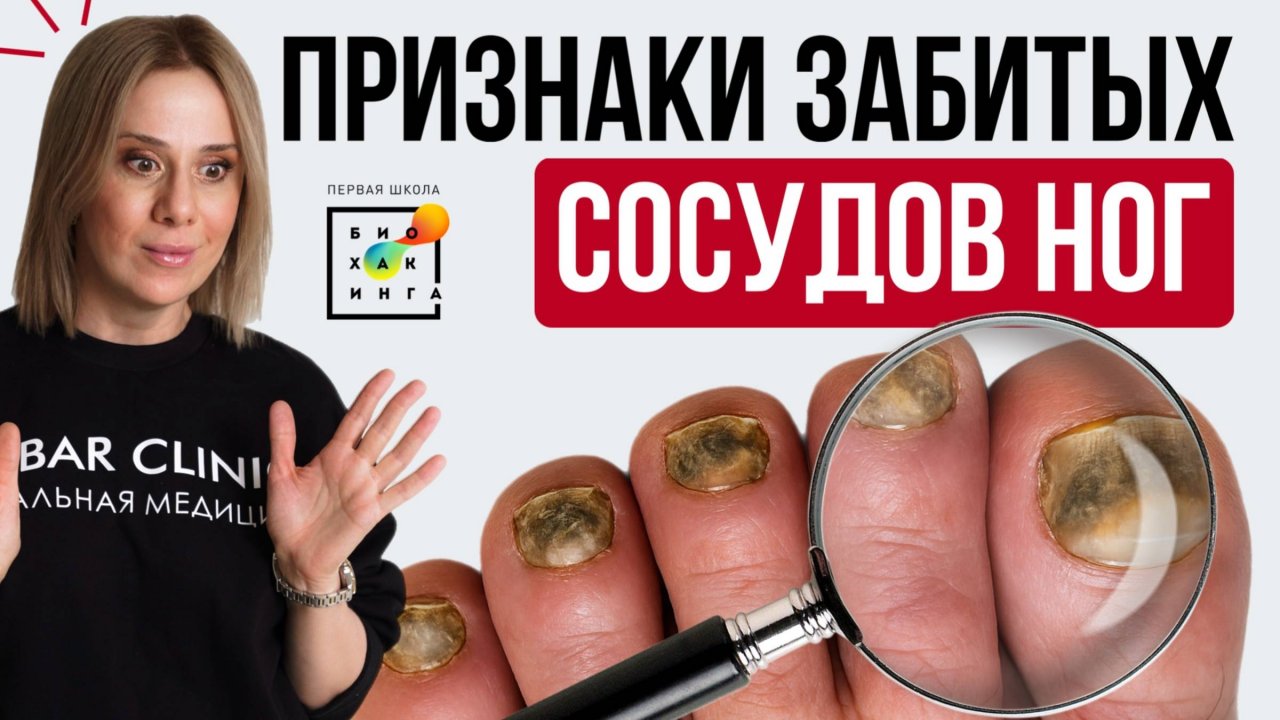 Признаки ЗАБИТЫХ сосудов ног. Как проверить? #пшб #иринабаранова