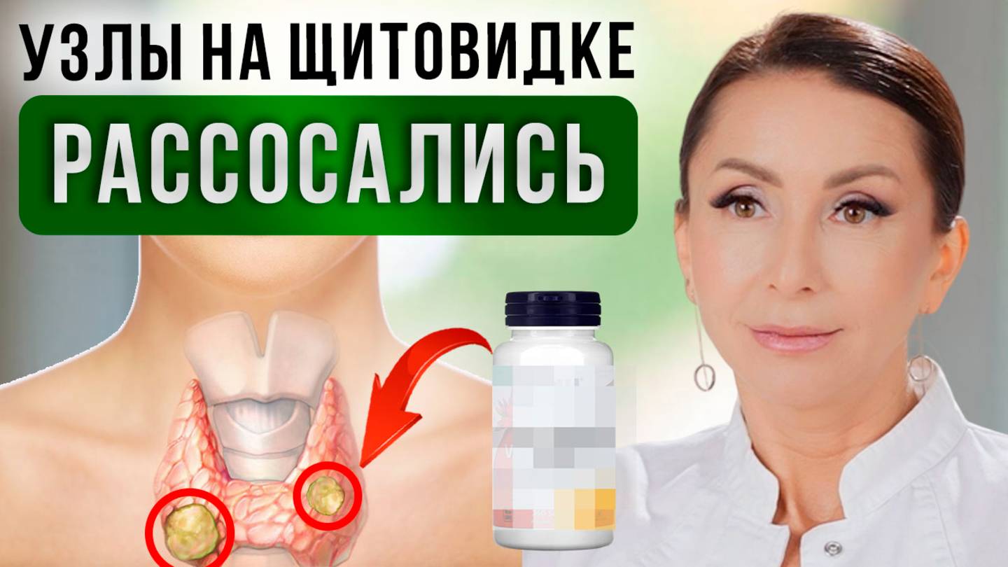 Инт Как УМЕНЬШИТЬ УЗЛЫ щитовидной железы БЕЗ ОПЕРАЦИЙ? Лечение щитовидной железы
