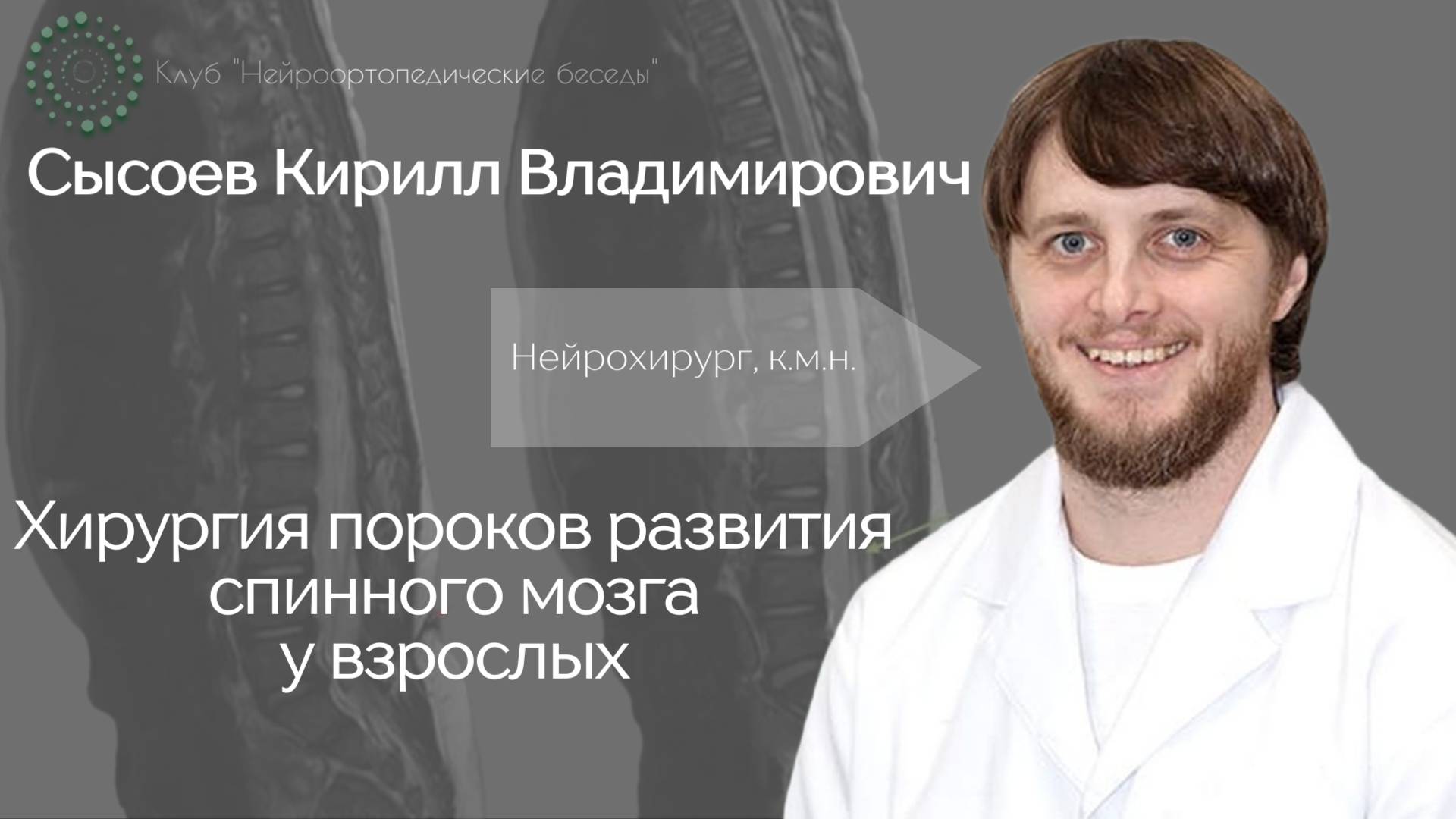 Хирургия пороков развития спинного мозга у взрослых