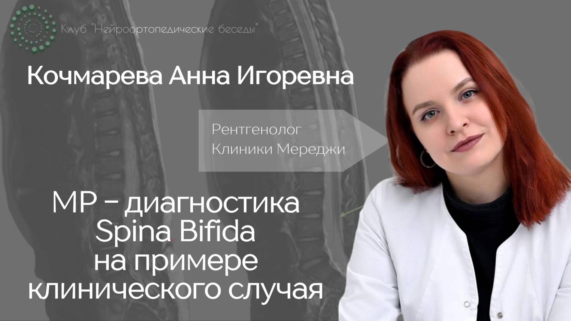 МР-диагностика spina bifida на примере клинического случая