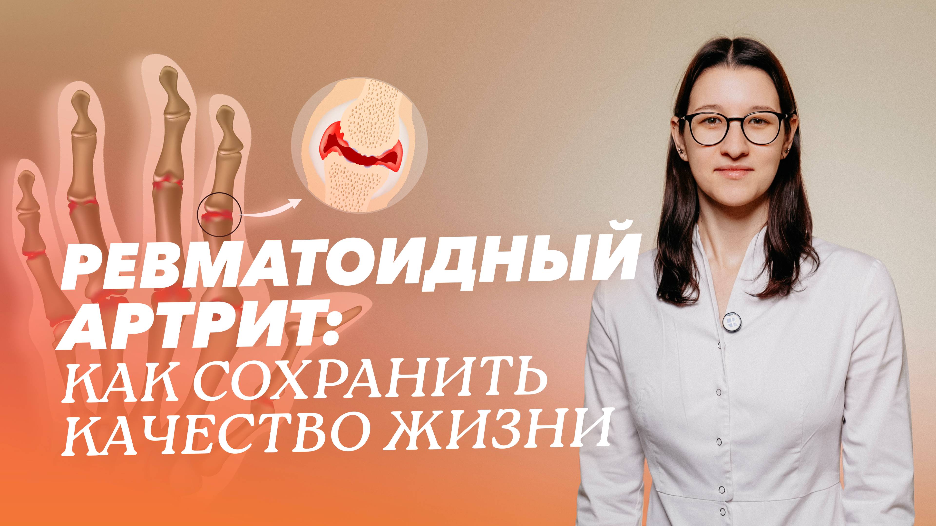 Ревматоидный артрит под контролем: симптомы, диагностика и лечение