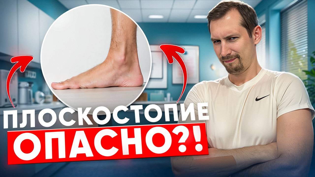 Что такое плоскостопие и возможно ли его вылечить? Полный гид!