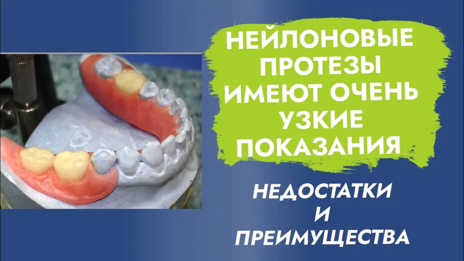 Эластичные - гибкие съемные протезы. МИНУСЫ и плюсы!