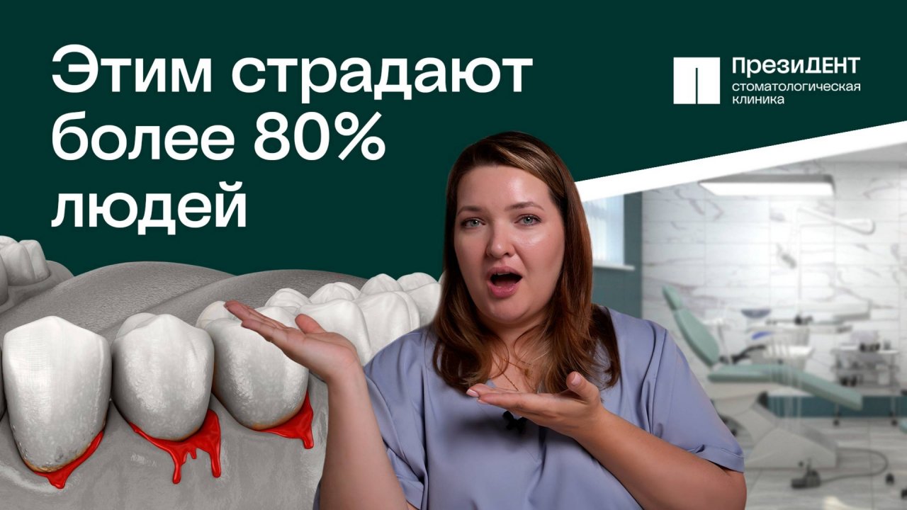 Шатается зуб: пародонтит! Что делать? Причины, последствия, лечение. | ПрезиДЕНТ 💚