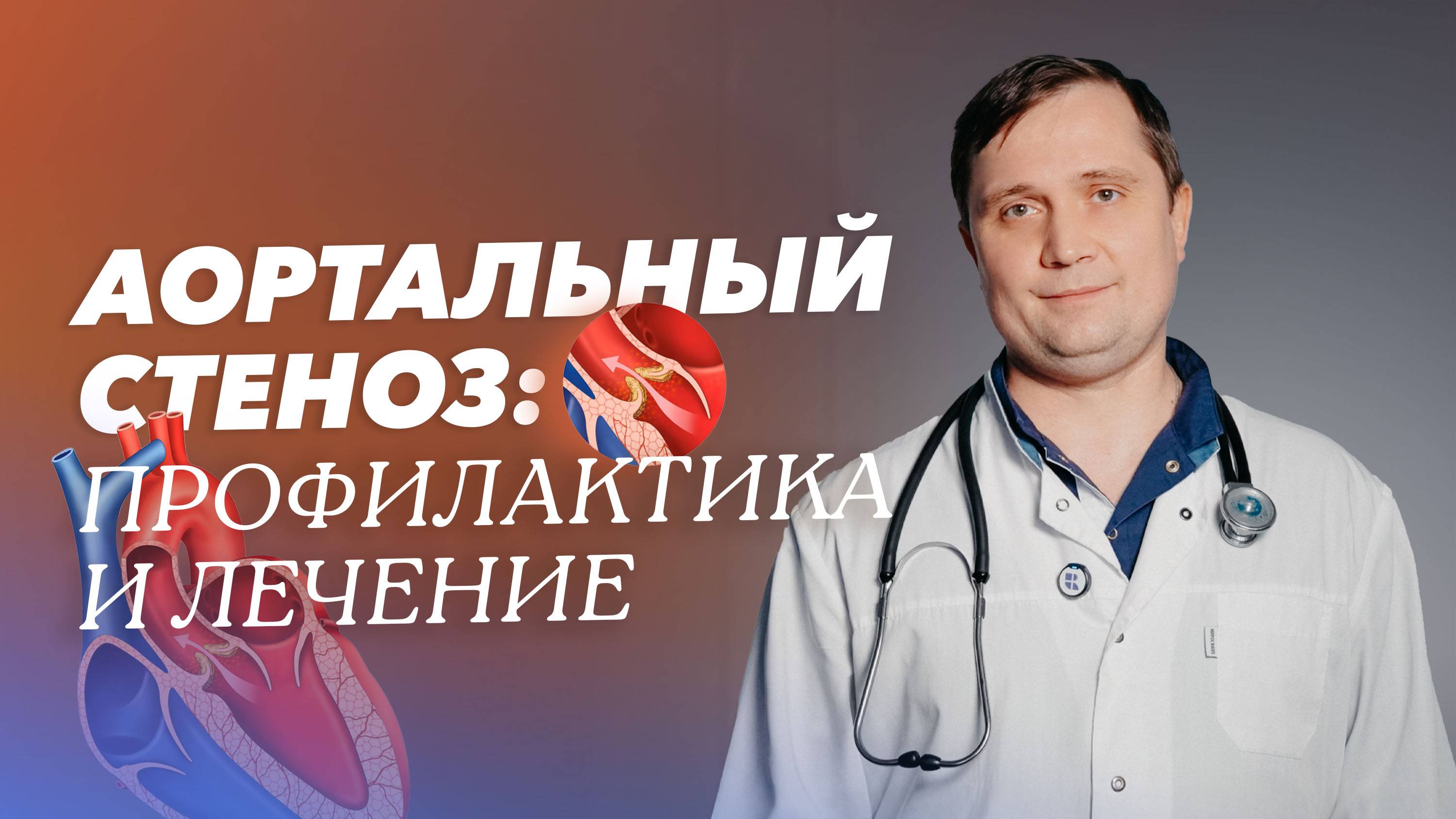 Аортальный стеноз: симптомы, лечение и профилактика