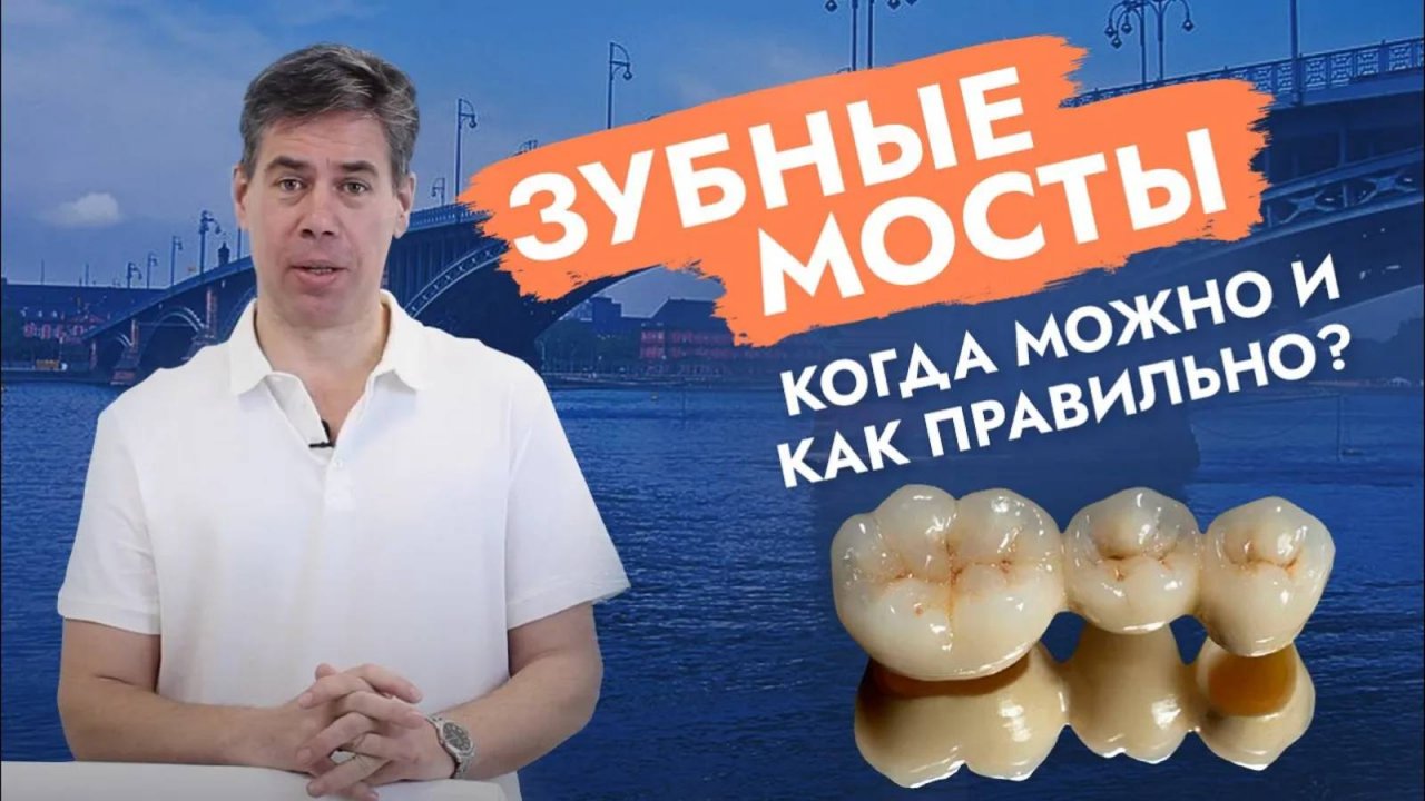 Когда зубной мост простоит долго, а когда навредит?