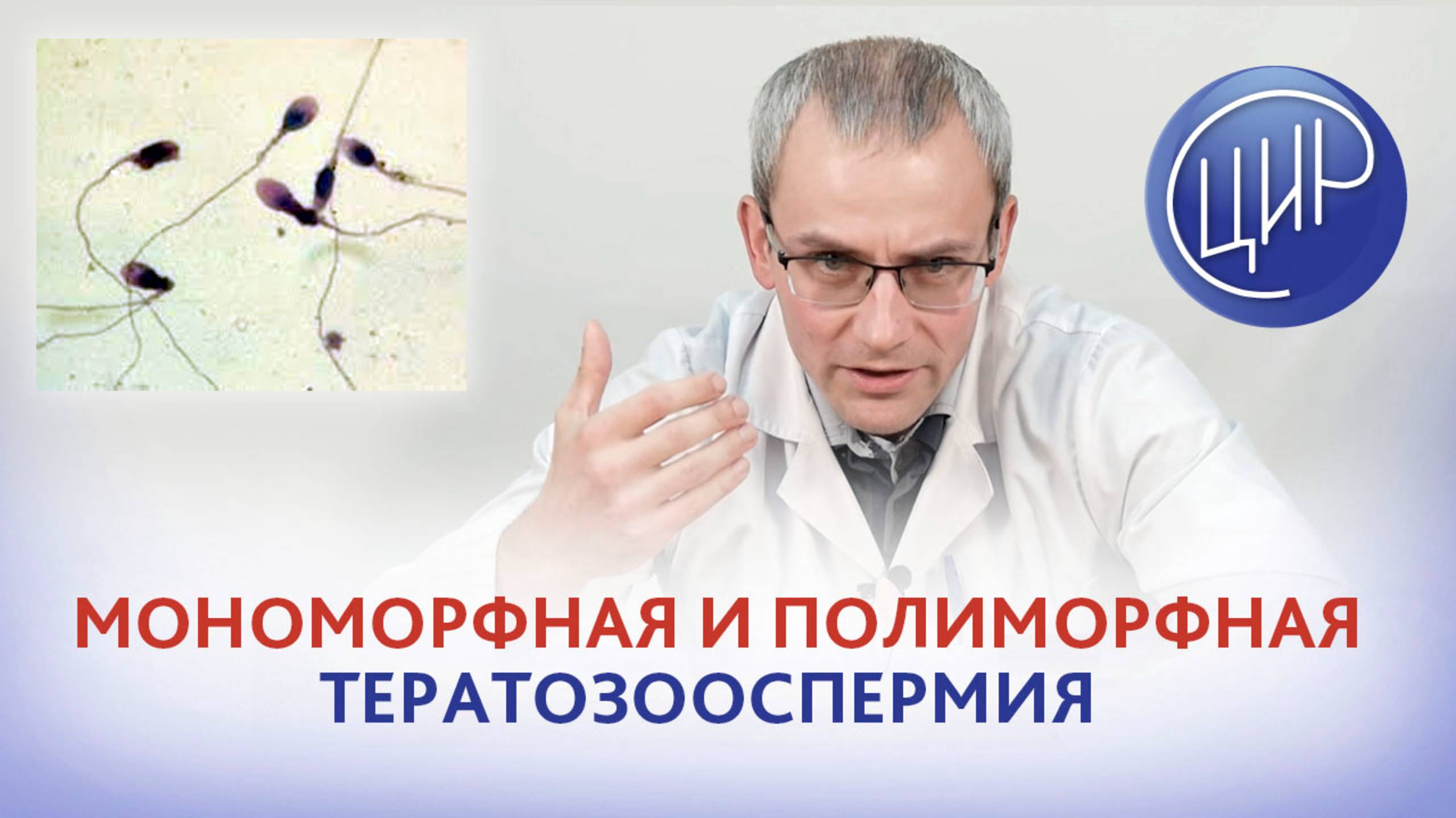 Тератозооспермия: мономорфная и полиморфная тератозооспермия. Андрей Романович Живулько.