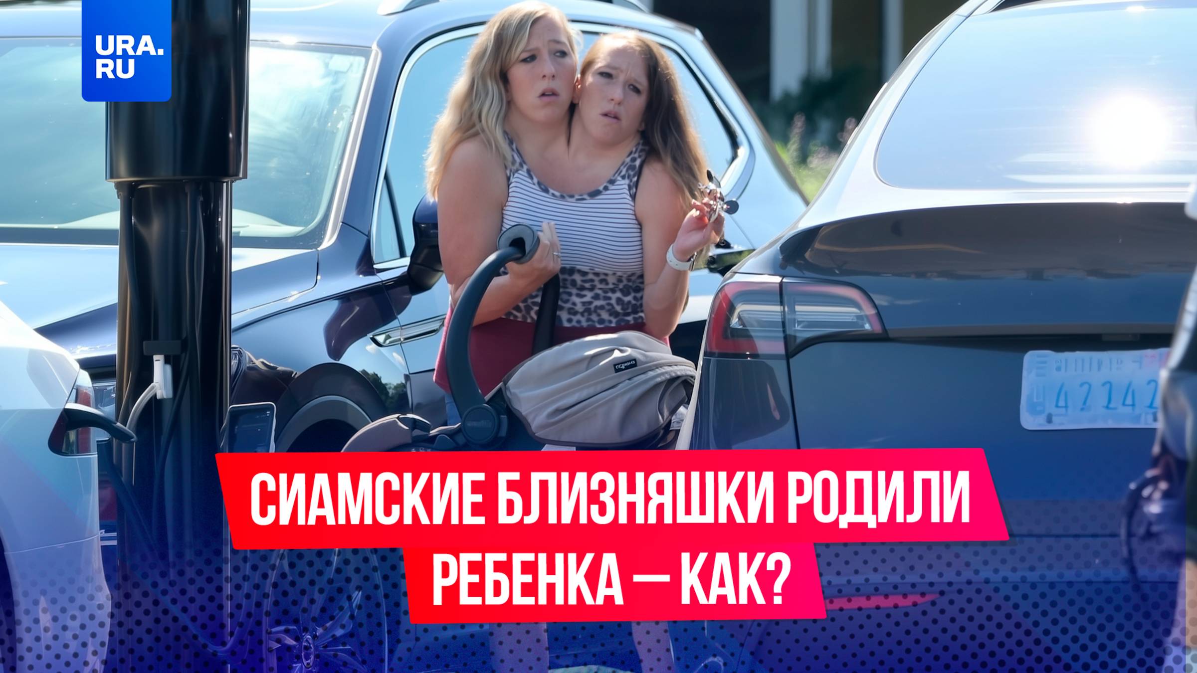 «А кто же мать?»: сиамские близнецы подарили жизнь ребенку