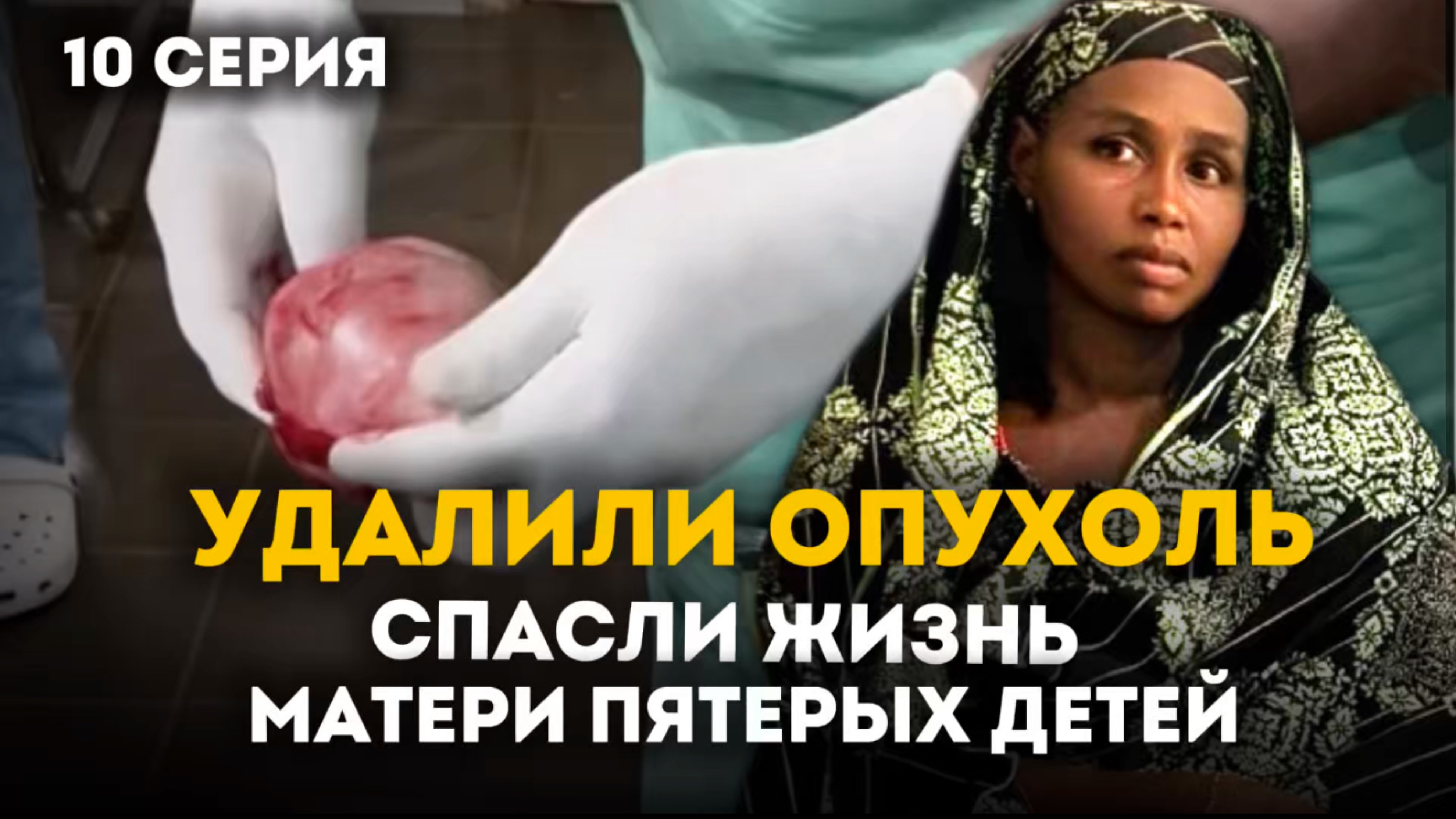 Спасли маму пятерых детей — история одной операции | Приключения акушерки в Африке 1 сезон 10 серия