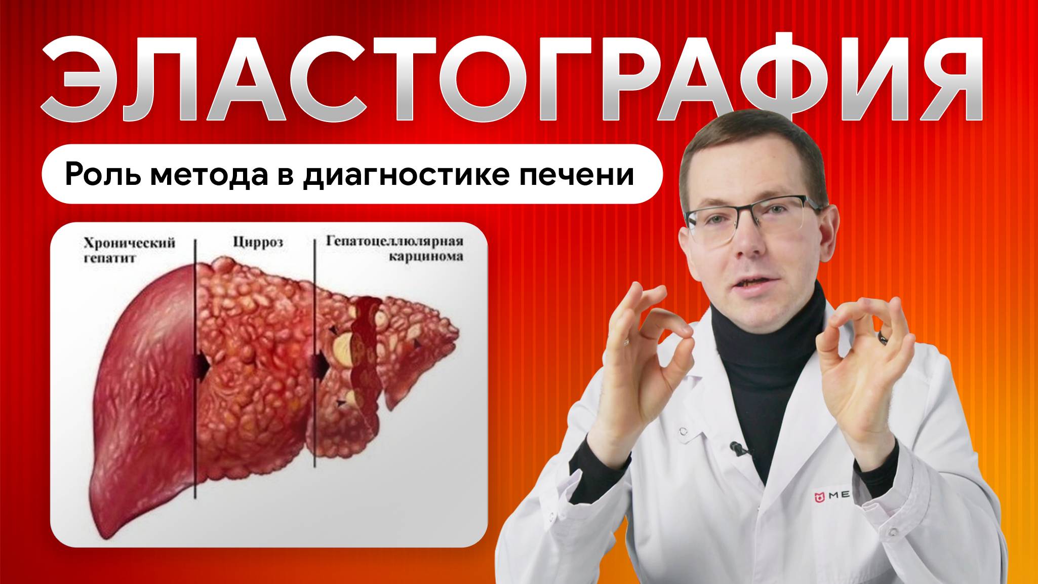 Эластография печени. Роль метода в диагностике заболеваний печени