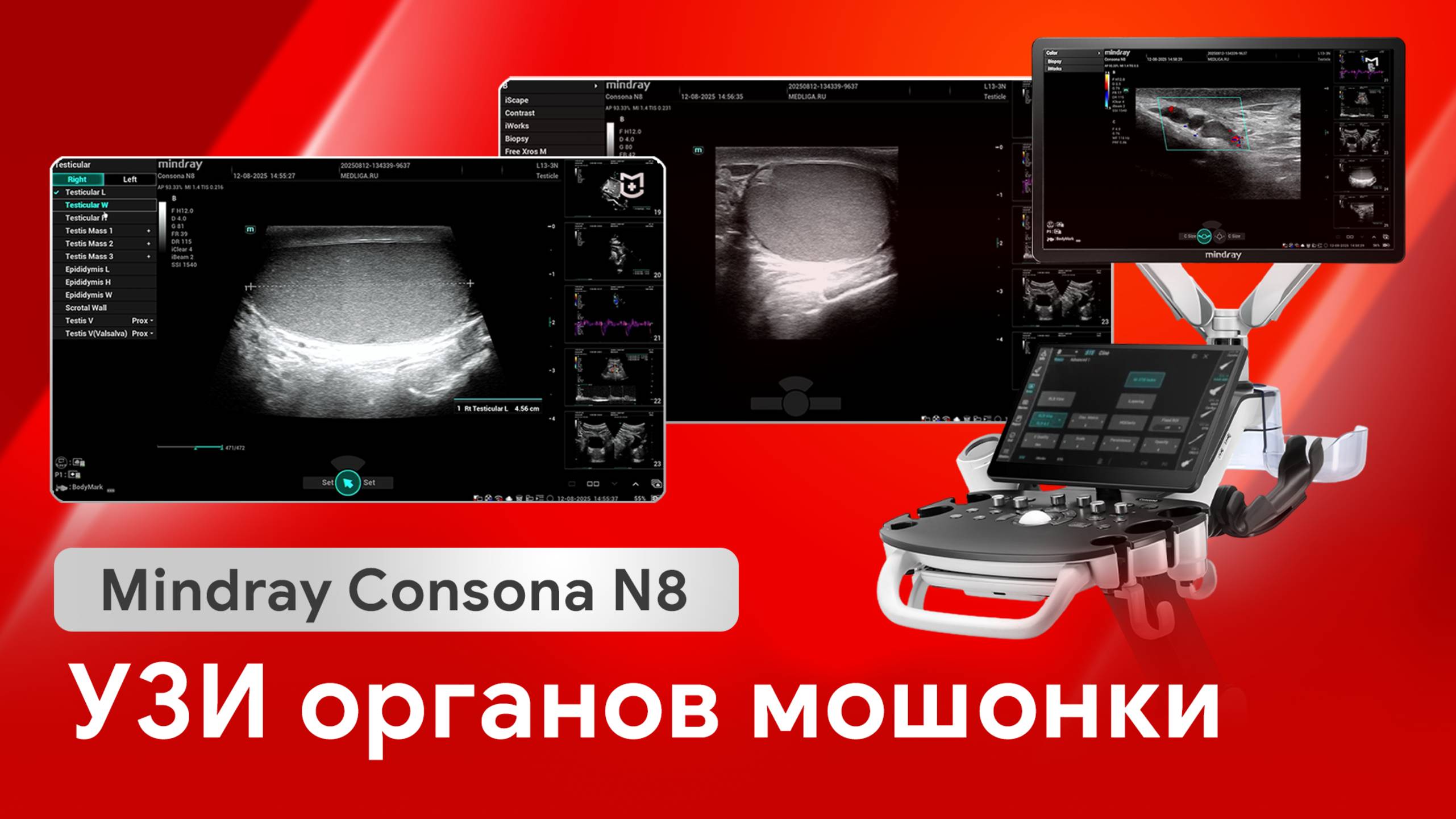 УЗИ мошонки: мастер-класс на Mindray Consona N8