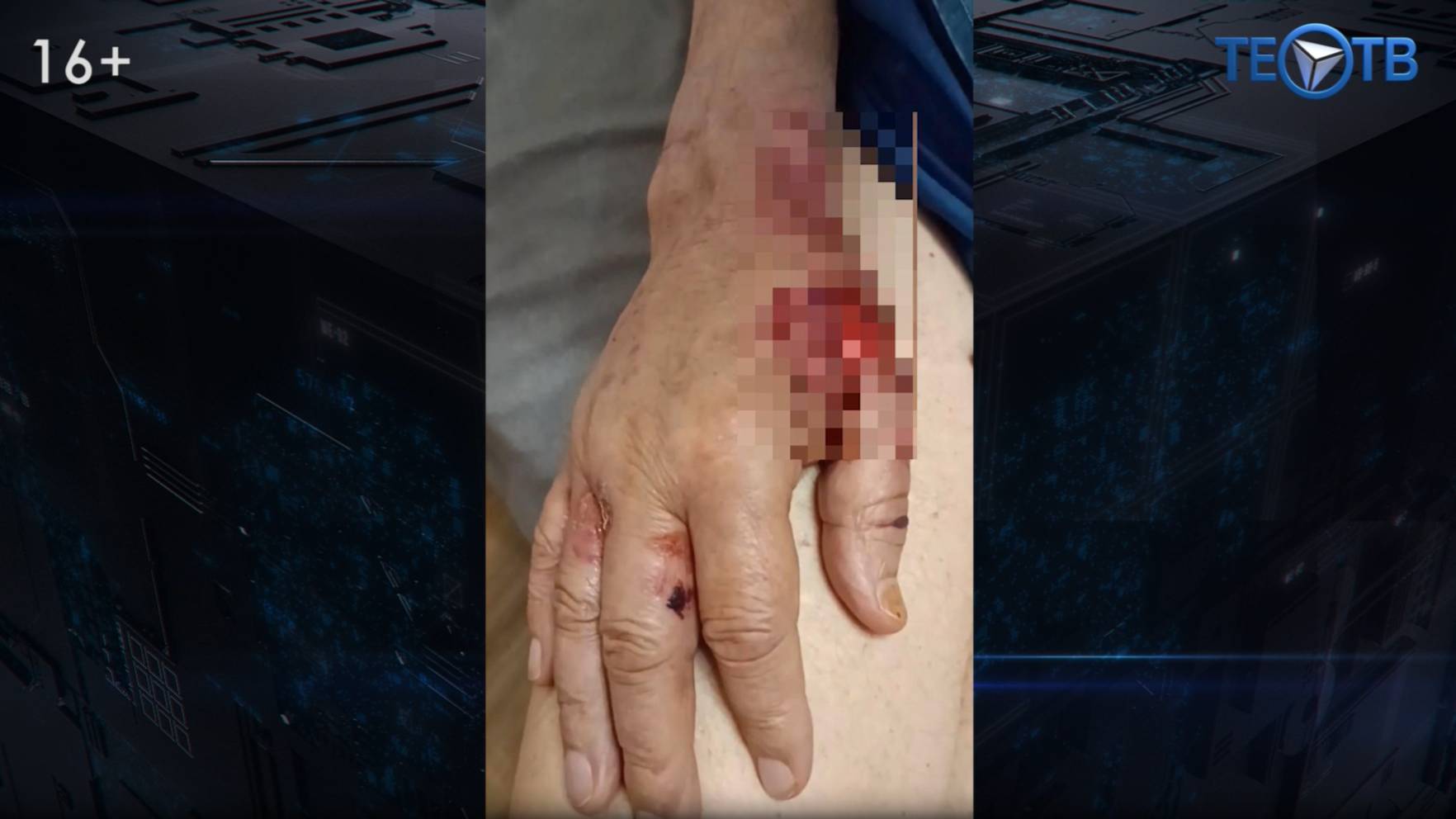 Пенсионера избили в частном доме престарелых