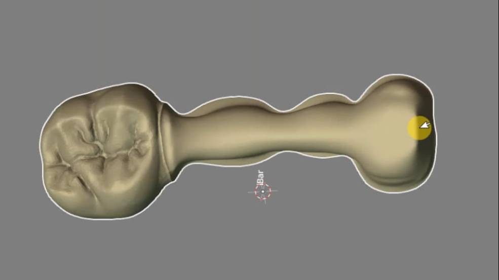 Моделирование в BlenderForDenal: Балка + зуб