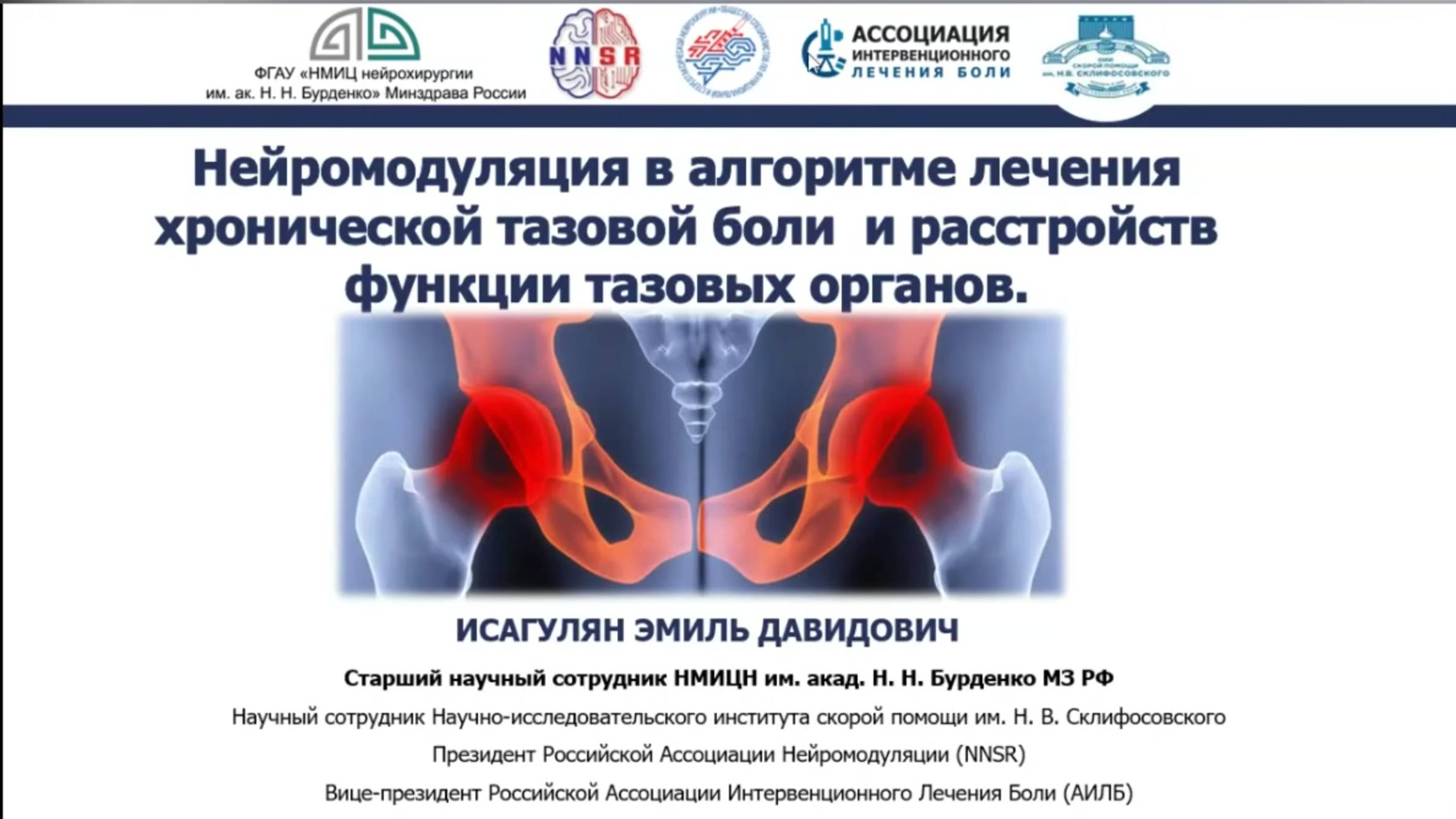 Место нейромодуляции и сосудистой эмболизации при СХТБ