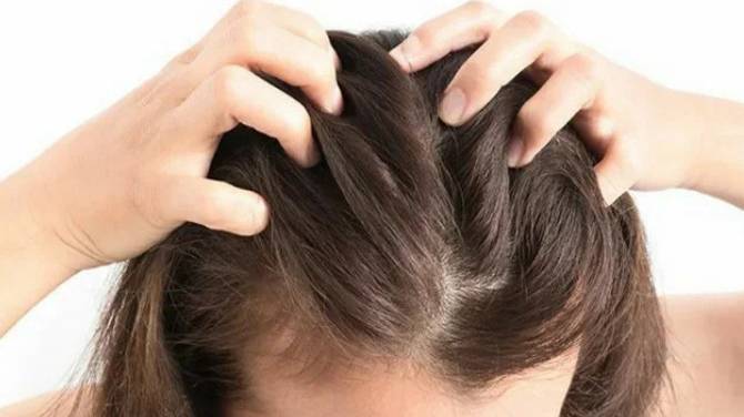 Сухая кожа головы