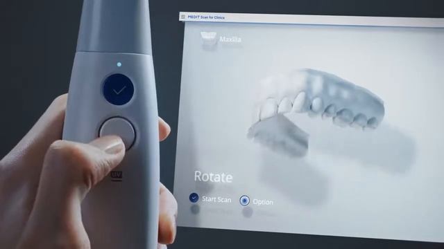 Представляем Medit i700. Цифровая эстетика | Вилана Дент