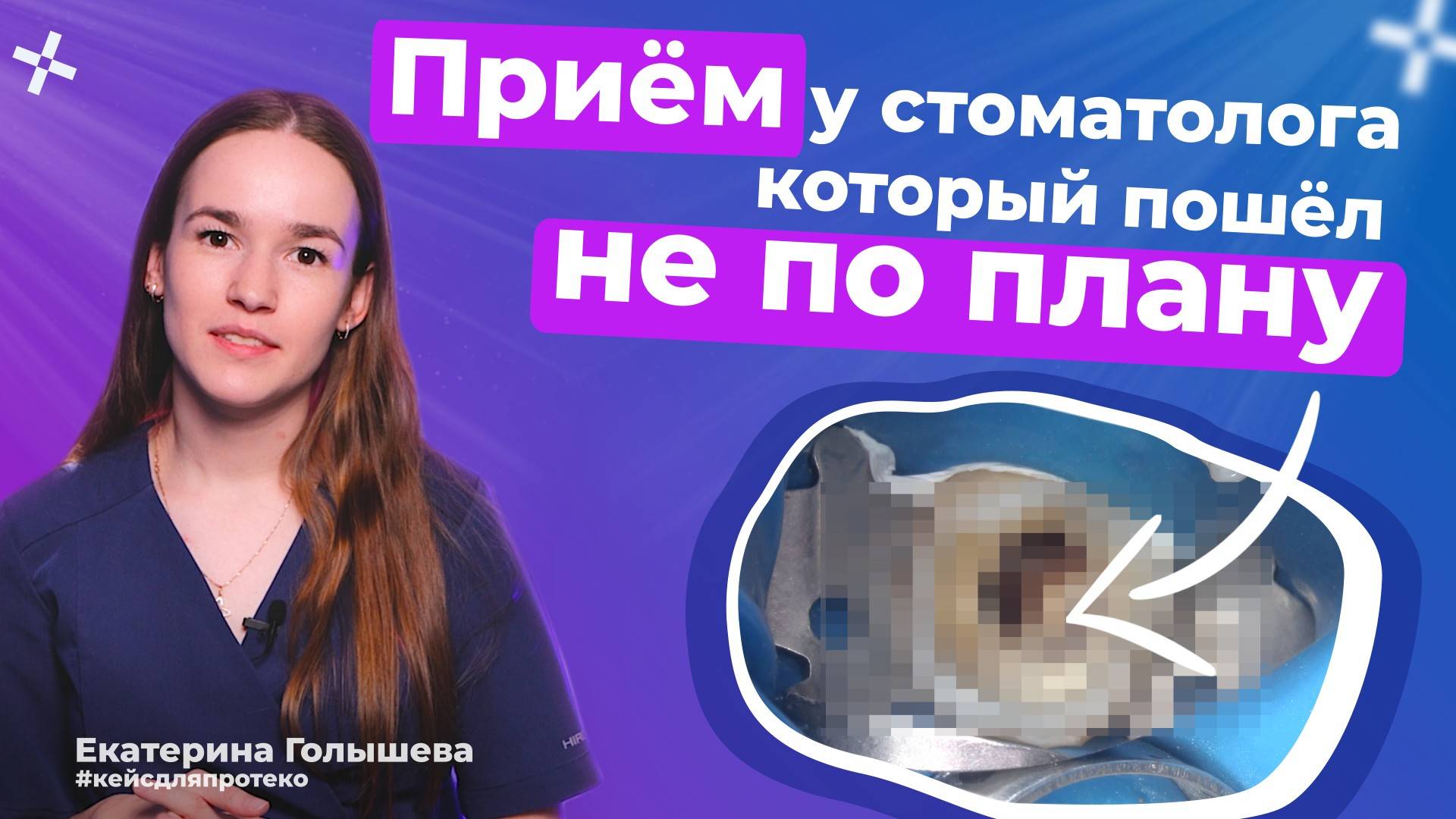 Что может пойти не так при лечении кариеса? | Реставрация зуба