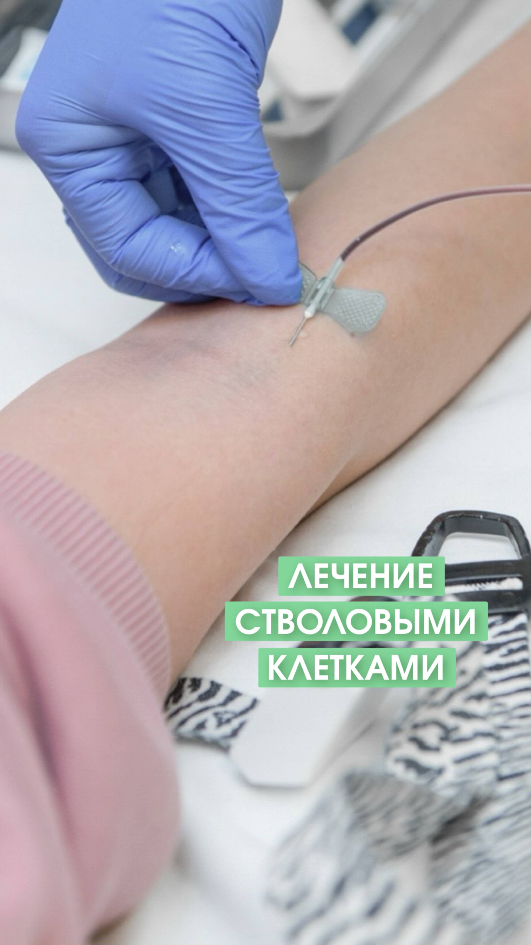 Лечение аутизма стволовыми клетками