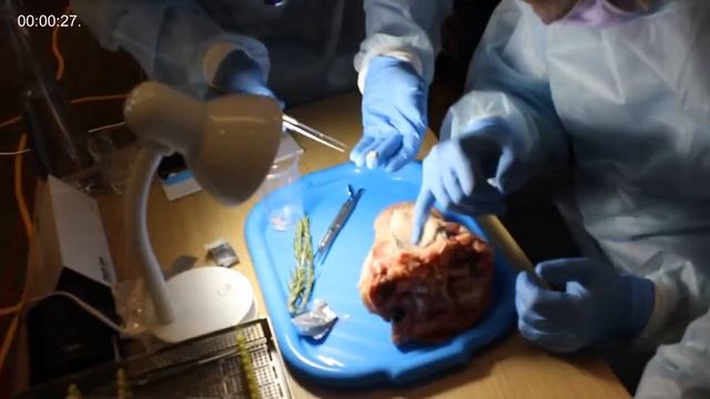 Курс - Пластика мягких тканей для достижения эстетических и предсказуемых резуль