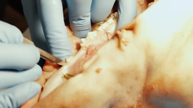 Курс - Как стать имплантологом. Лектор А. С. Герасимов. Октябрь 2018 г.