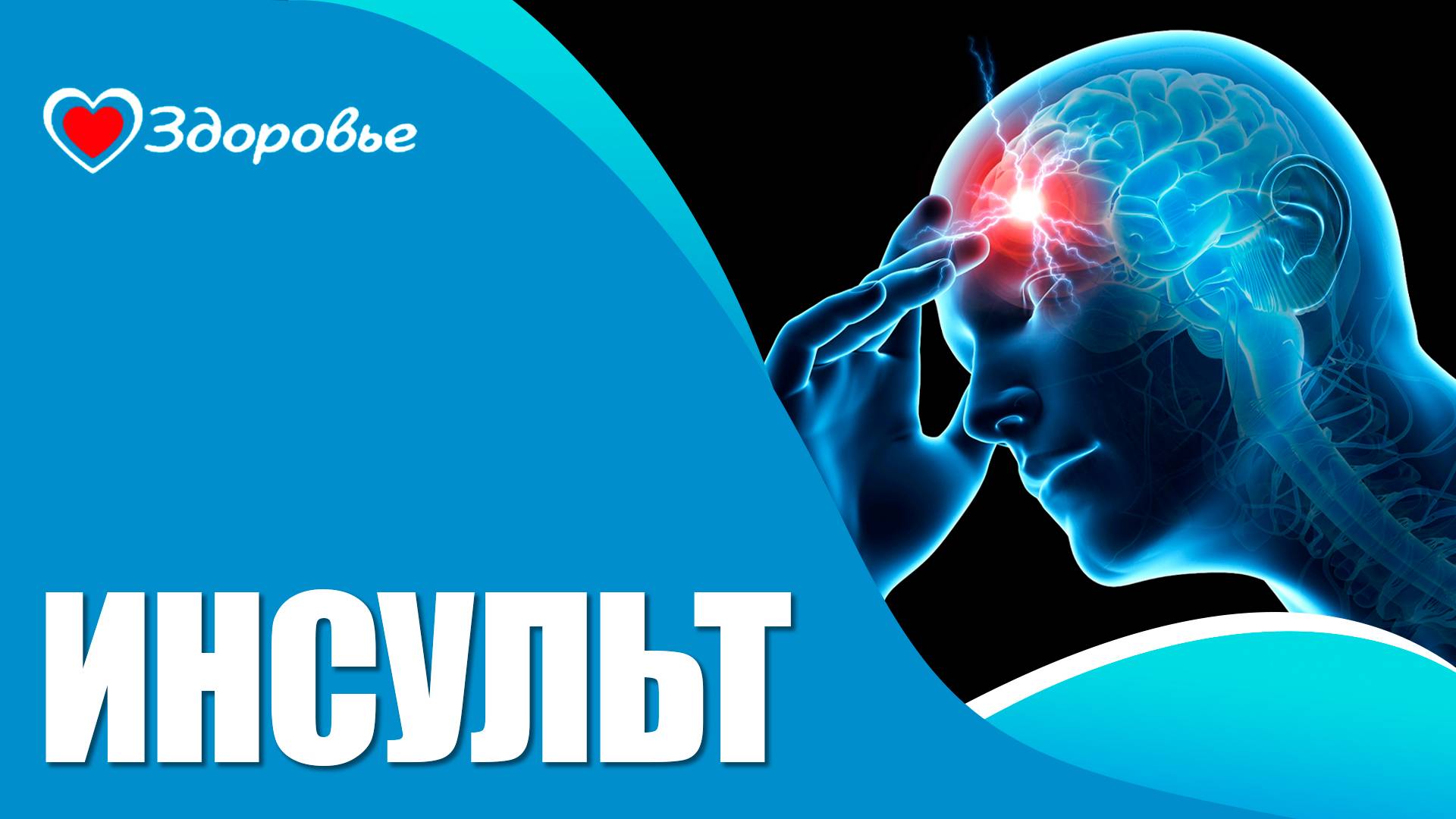 Здоровье. Восстаноление после инсульта