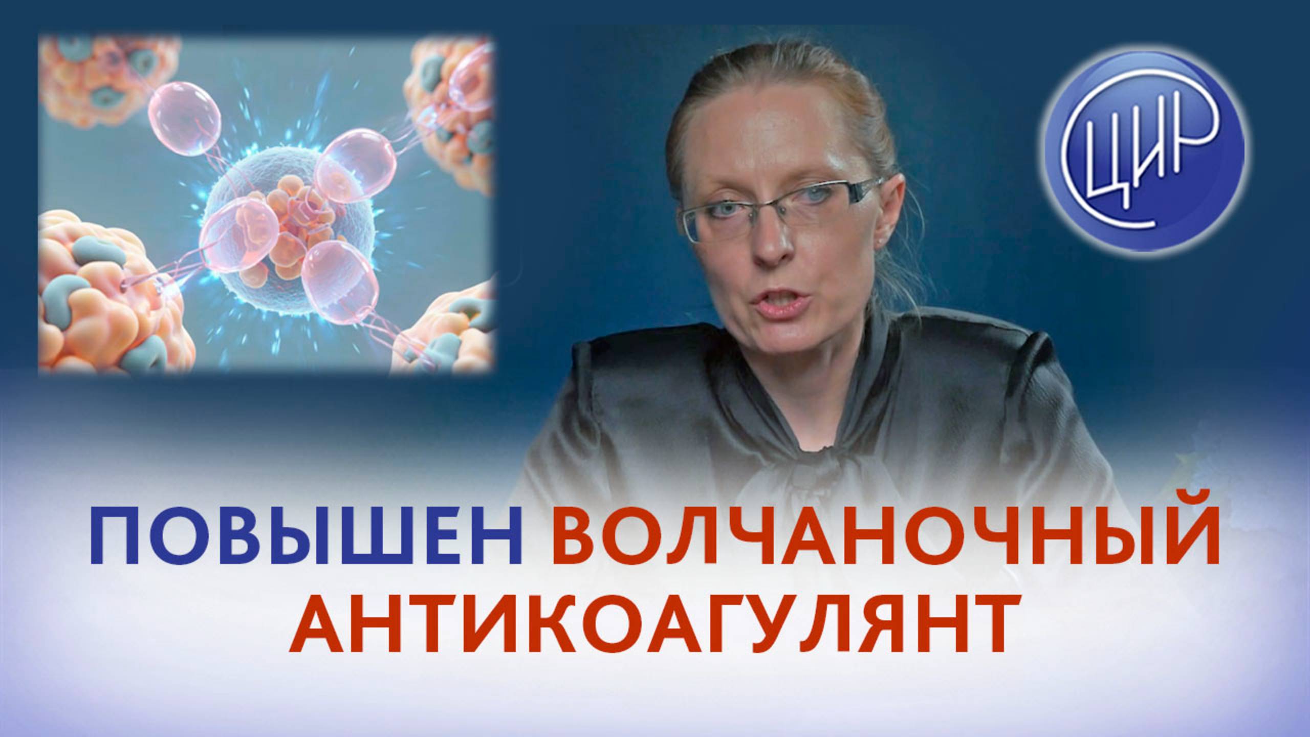 Повышен волчаночный антикоагулянт при отрицательных аутоиммунных антителах.