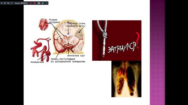 тема № 15-141-17.12.25 курение и его влияние на состояние здоровья