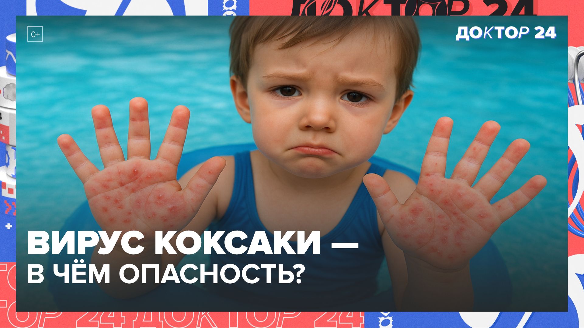 ВИРУС КОКСАКИ: КАК ЗАРАЖАЮТСЯ, СИМПТОМЫ У ДЕТЕЙ И ВЗРОСЛЫХ, ЧЕМ ОПАСЕН И КАК ЗАЩИТИТЬСЯ? | Доктор 24