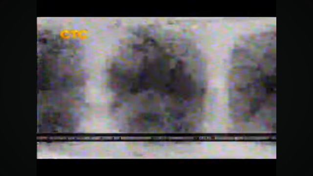 RAH:sts_profilaktika2013