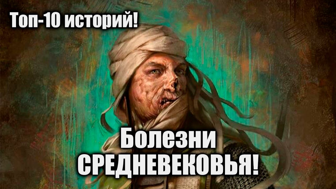 10 историй - Болезни Средневековья #средневековье #средниевека #история #топ10 #еда #питание