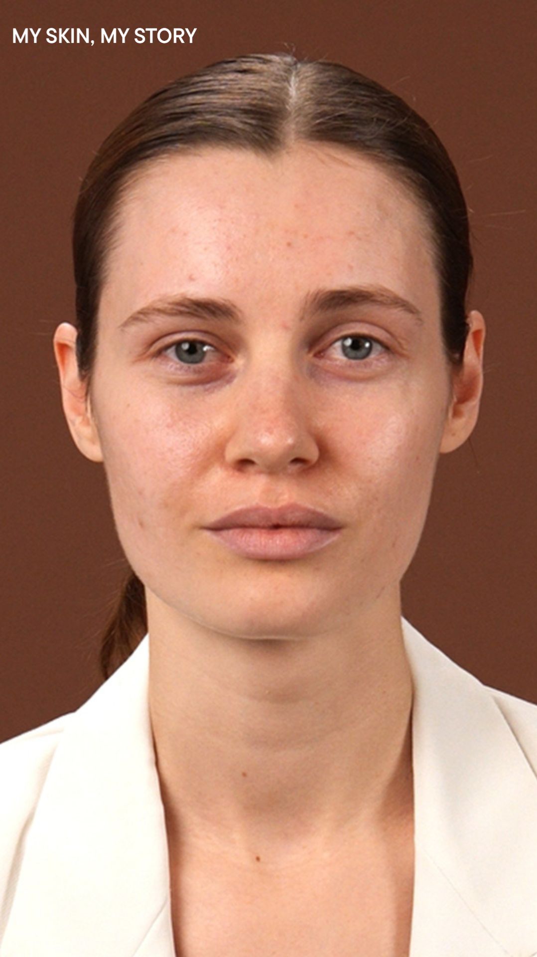 BABOR_MY SKIN, MY STORY: Валерия — 10 лет борьбы с высыпаниями и поиском решения