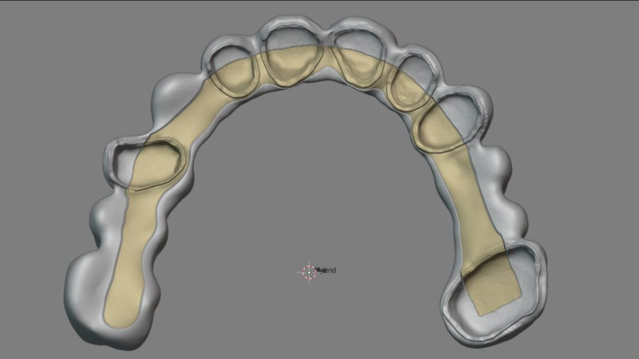 Моделирование балочной конструкции на культях
