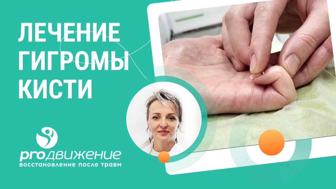 🩺  Лечение гигромы кисти