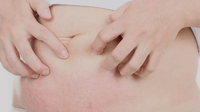 Сыпь при беременности