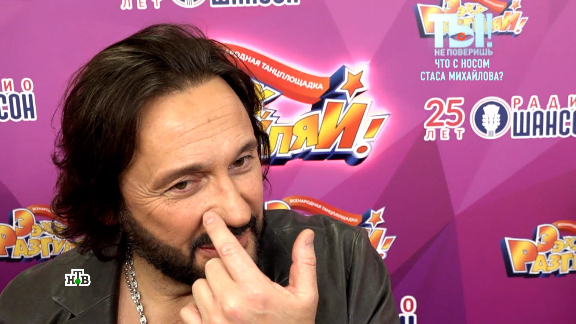 На носу Стаса Михайлова появилась странная шишка | «Ты не поверишь!»