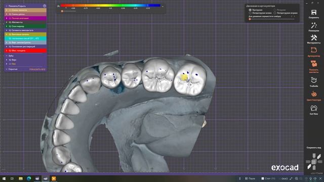 Формирование фиссур #1