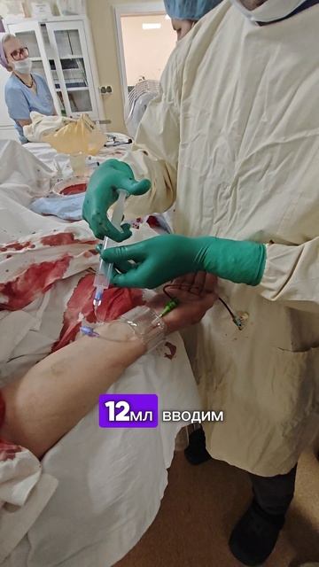 Цивилизованный гемостаз браслетом Ньюмен после стентирования артерий сердца