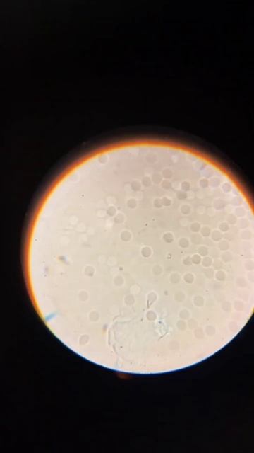 Работа фуллерена на кровь под микроскопом.