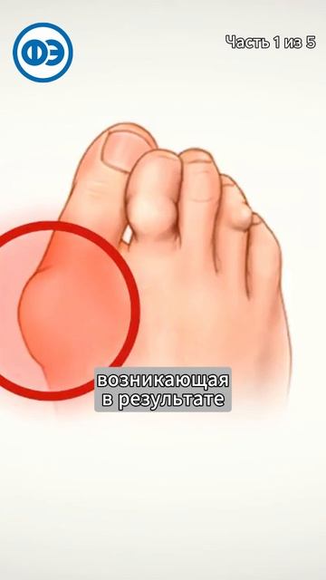 1 часть: Силиконовые вкладыши 🦶