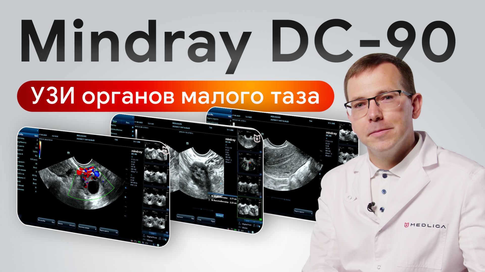 Mindray DC-90: стандартное гинекологическое исследование