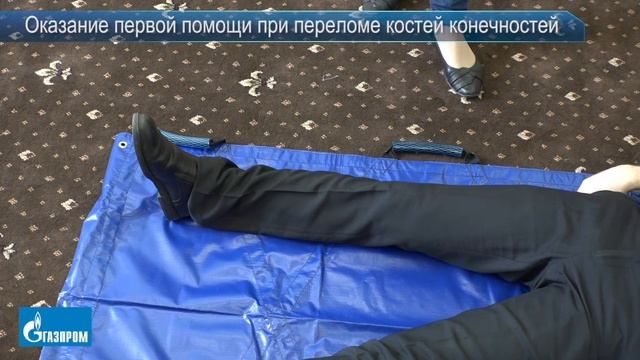 7. Оказание первой помощи при переломе костей конечностей