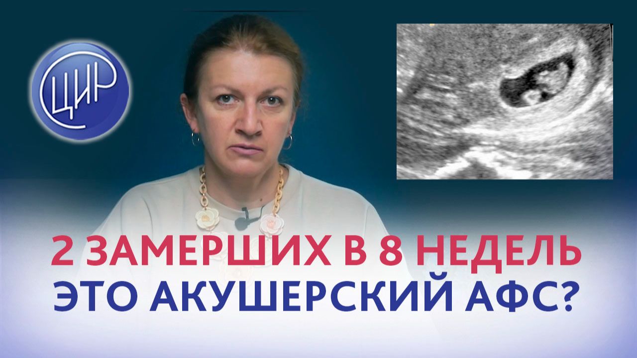 2 замерших беременности в 8 недель и волчаночный антикоагулянт. Это акушерский АФС?