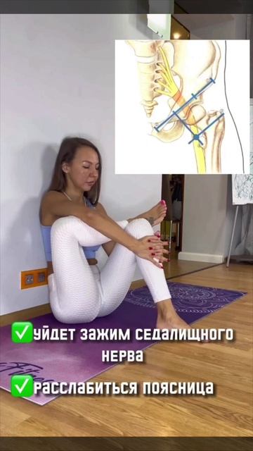 Седалищный нерв