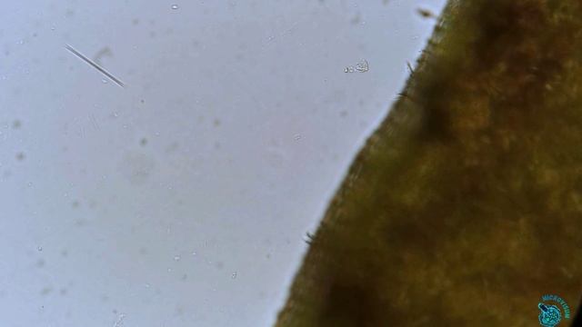 Сувойки (Vorticella)