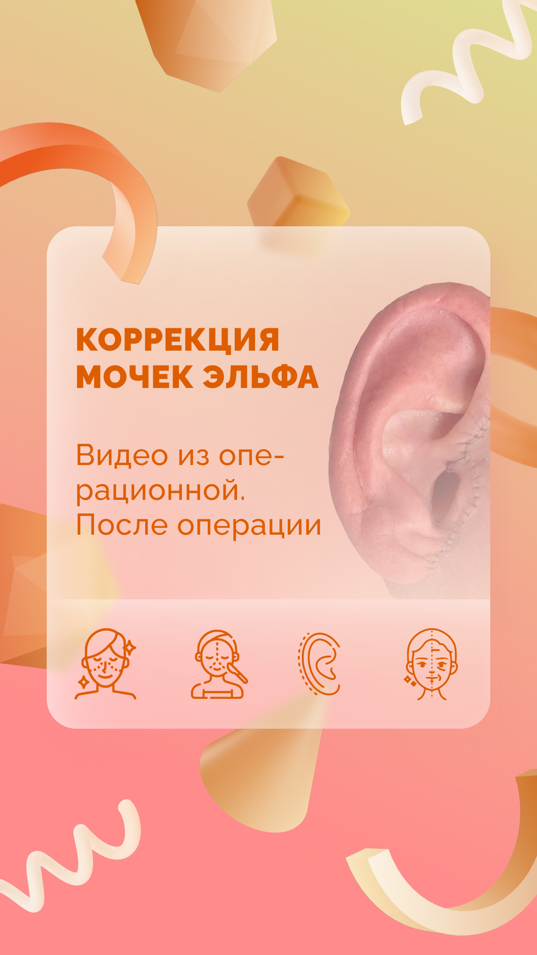 Коррекция мочек эльфа. Видео из операционной. После операции