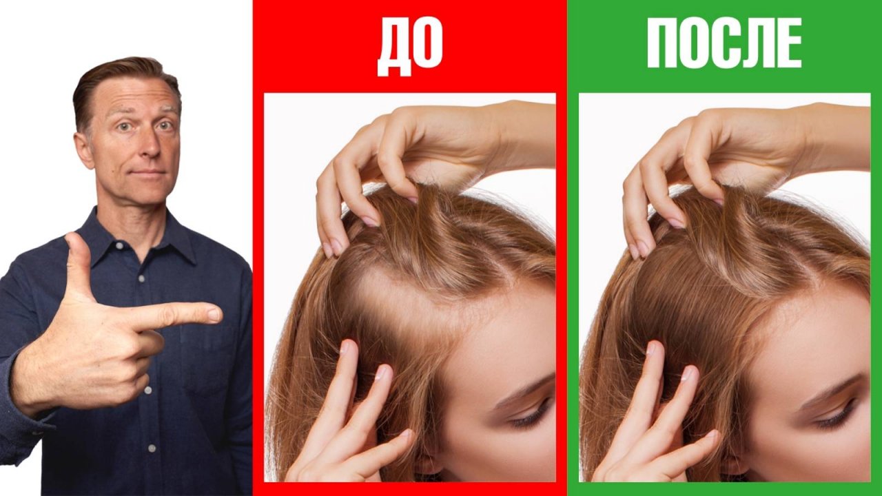 Как сделать волосы гуще? Простые советы👌