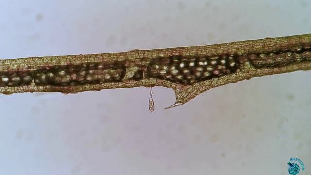 Кругоресничные инфузории (Peritricha)