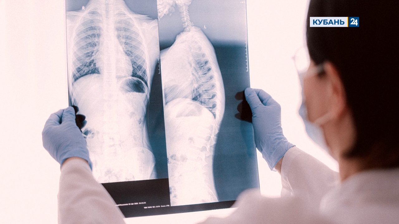 Химический ожог пищевода | История болезни 07.07.2022